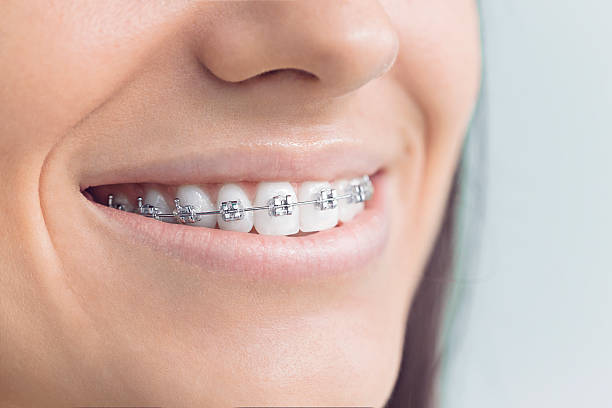 TMJ/TMD Treatment in East Palo Alto, CA